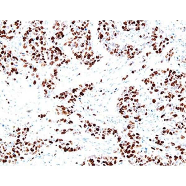 Antibody, Ki67